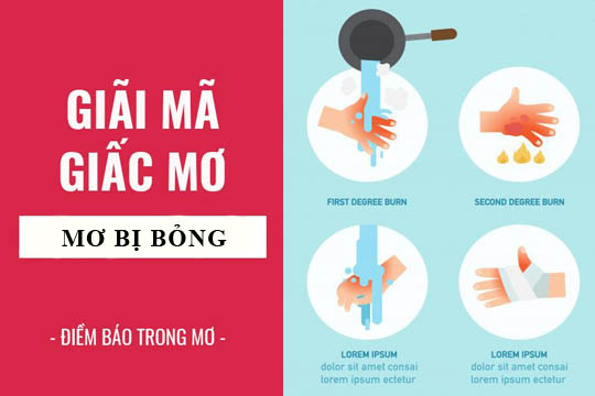 bong nuoc soi